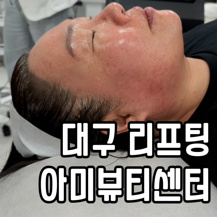  대구리프팅 잘하는 곳 아미뷰티센터 티리온X 후기
