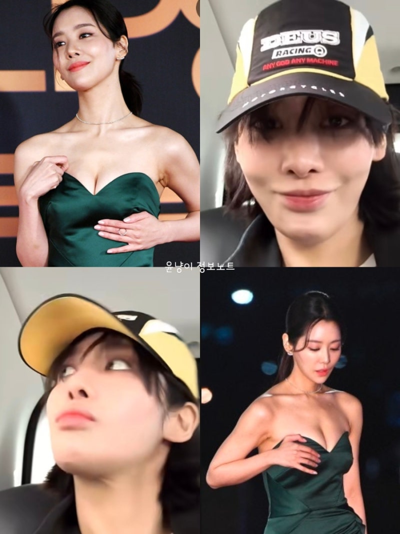 차주영, 3개월 만에 근황 공개 차주영, 코피 수술 후 3개월…“꺄하 봄이당” 근황