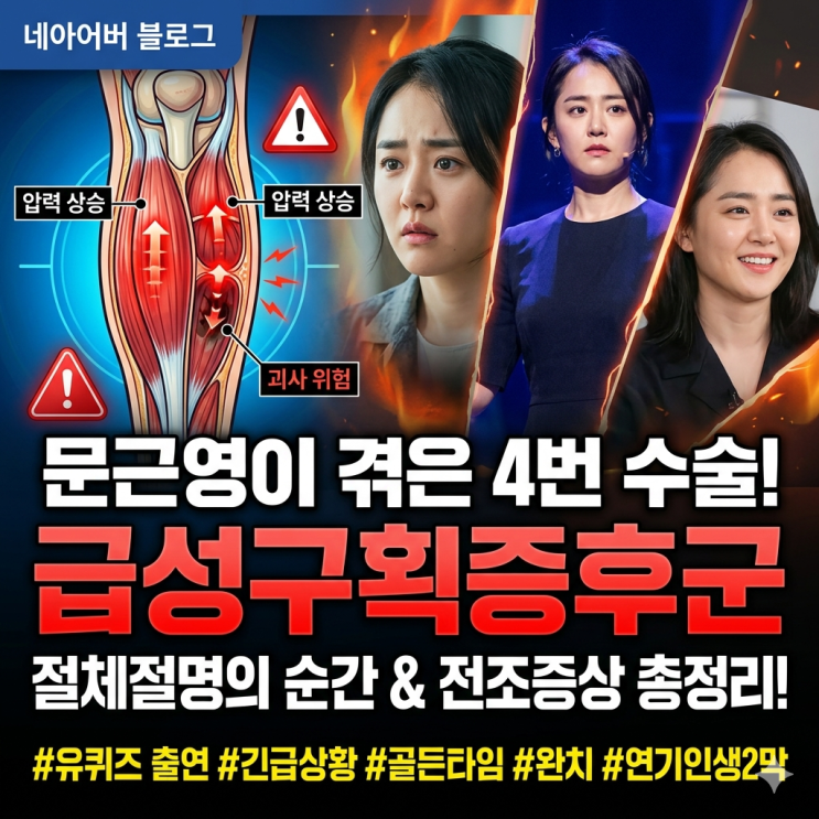  문근영이 겪은 '급성구획증후군' 대체 뭐길래? 4번 수술한 이유와 꼭 알아야 할 전조증상