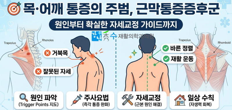 목·어깨 통증의 주범, 근막통증증후군 원인과 확실한 자세교정