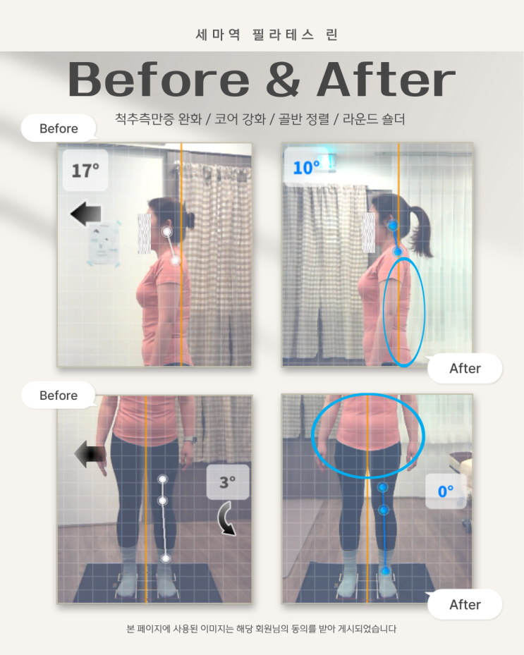  오산 필라테스 추천 |                                  체형분석 기반 자세 개선 Before After 후기