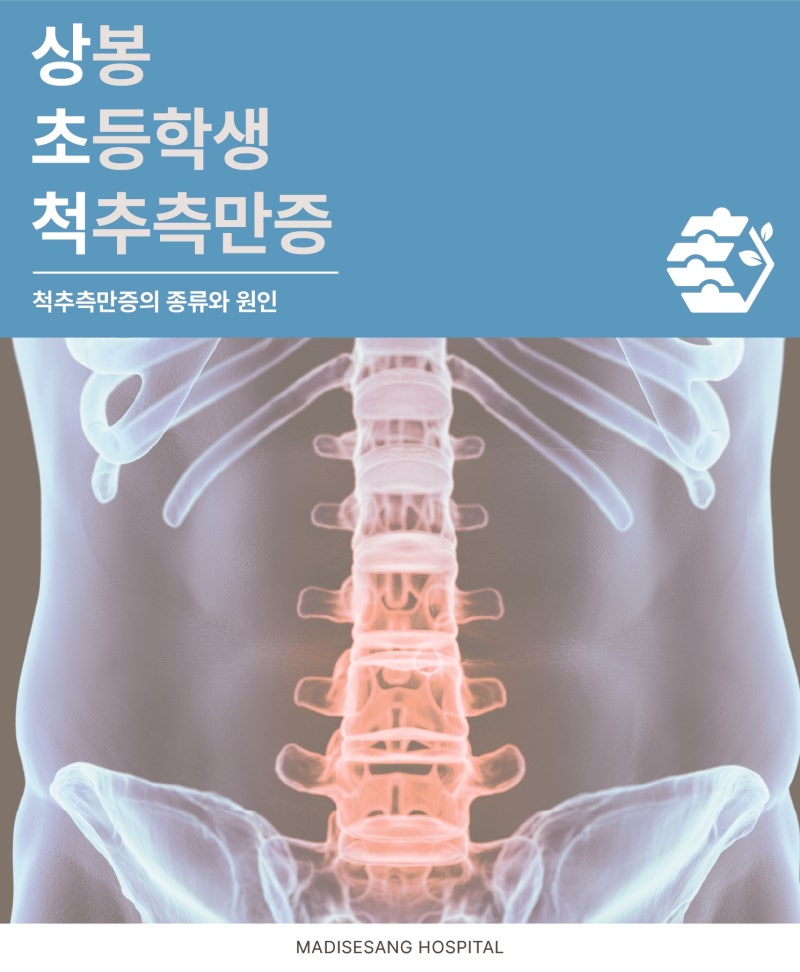 상봉 초등학생 척추측만증 보조기 꼭 해야할까요