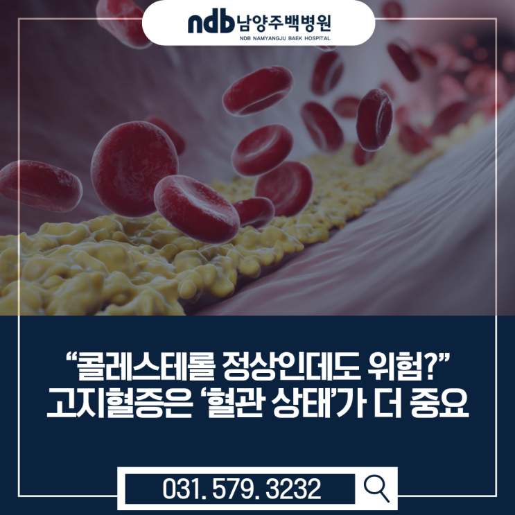  “콜레스테롤 수치 정상인데 위험?” 고지혈증은 혈관 상태가 더 중요합니다[남양주내과]