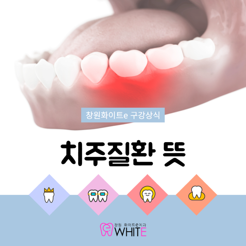 치주질환 뜻 종류와 예방법