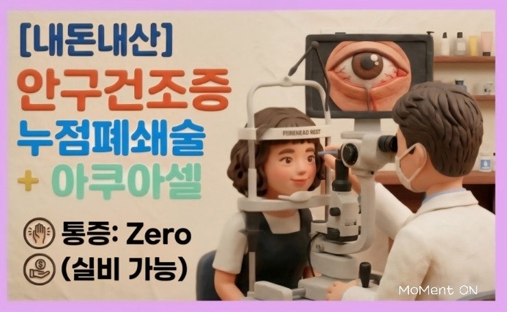  안구건조증 치료 후기｜누점폐쇄술 효과 + 아쿠아셀 가격·통증·실비 총정리[내돈내산]