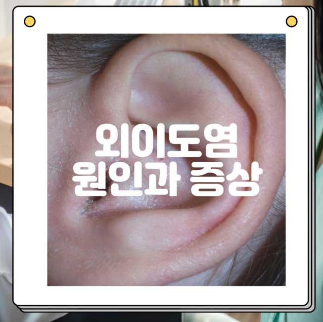귀에 불난 듯한 통증 '외이도염 증상' 5가지와 재발 막는 생활 수칙