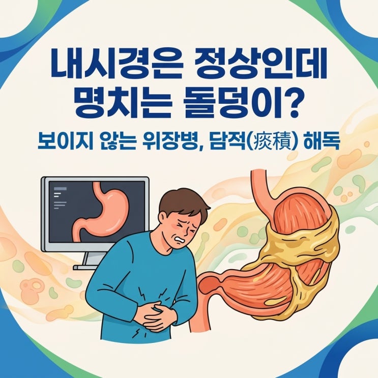  위염 내시경 정상인데 명치 통증 소화불량 원인, 담적병 담적증후군 한의원 치료