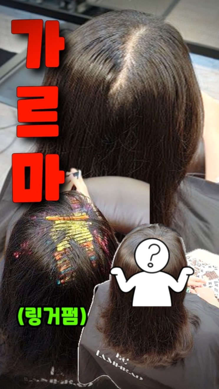  서울 성북구 월곡동 링거펌, 가르마 갈라짐 해결되는 모류교정 후기