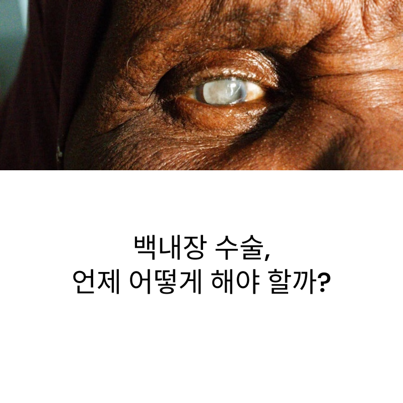 백내장 수술, '언제' 하고 '어떤 렌즈' 쓸까? (시기·종류·회복 기간 총정리)