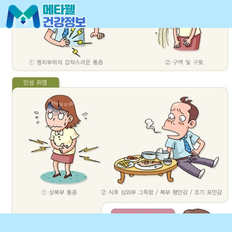갑자기 속이 쓰리고 명치가 아프다면? 급성 위염 초기증상, 원인, 치료 방법