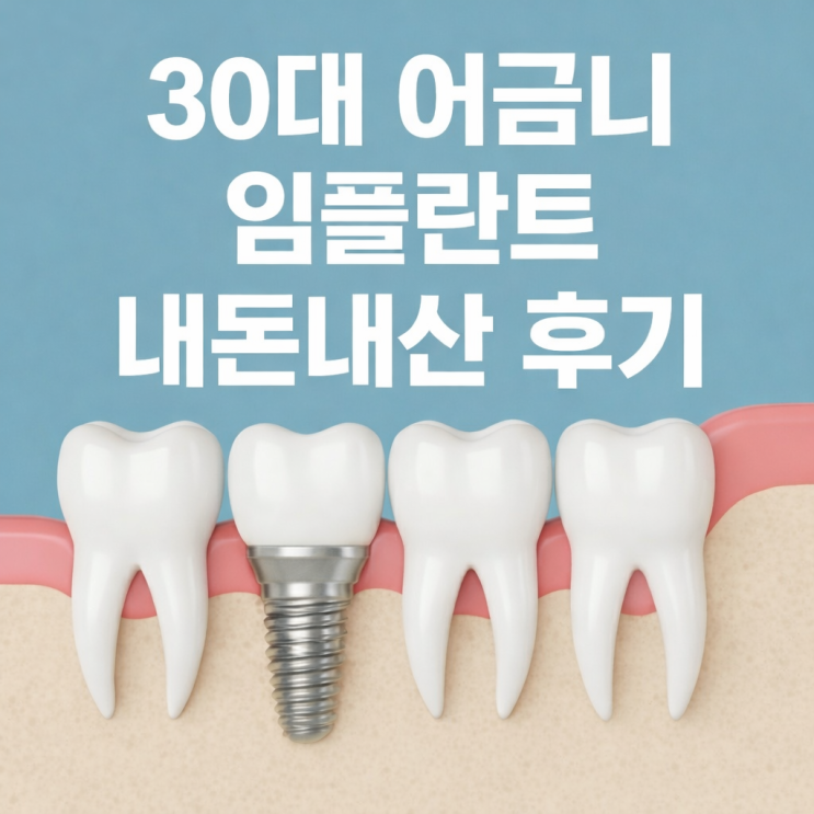  30대 어금니 임플란트 후기 (내돈내산) 통증 얼마나 아플까? 2탄