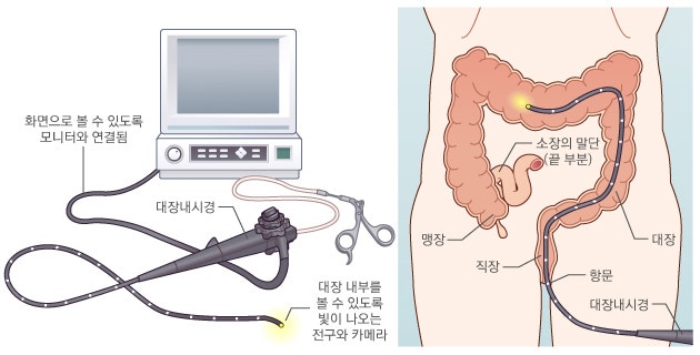 대장내시경 전 음식 총정리- 3일 전부터 준비하는 식단, 전날 식사, 금식 기준 - 대장내시경은....