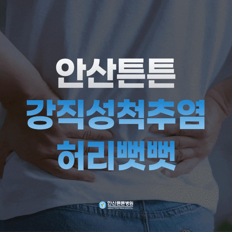 강직성척추염 증상과 치료, 척추가 굳는 병, 허리뻣뻣
