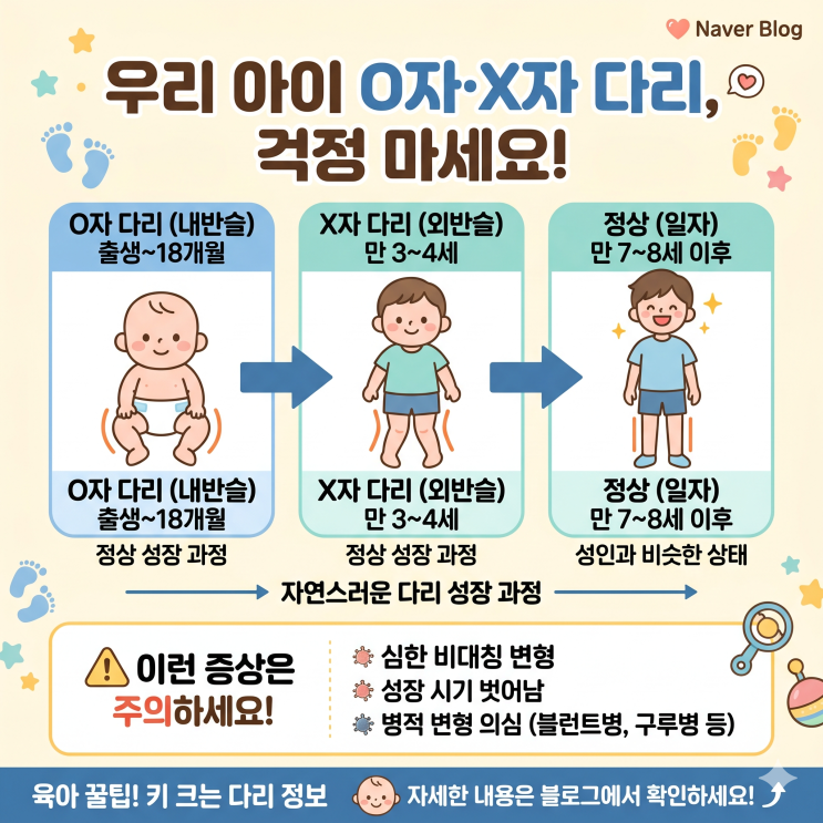  우리 아이 O자·X자 다리, "키 안 크면 어쩌죠?" 걱정 마세요!