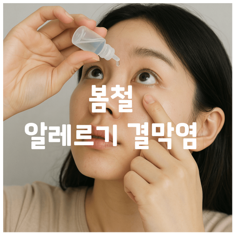  모충동 안과진료 눈가려움과 충혈 알레르기 결막염 신호일 수