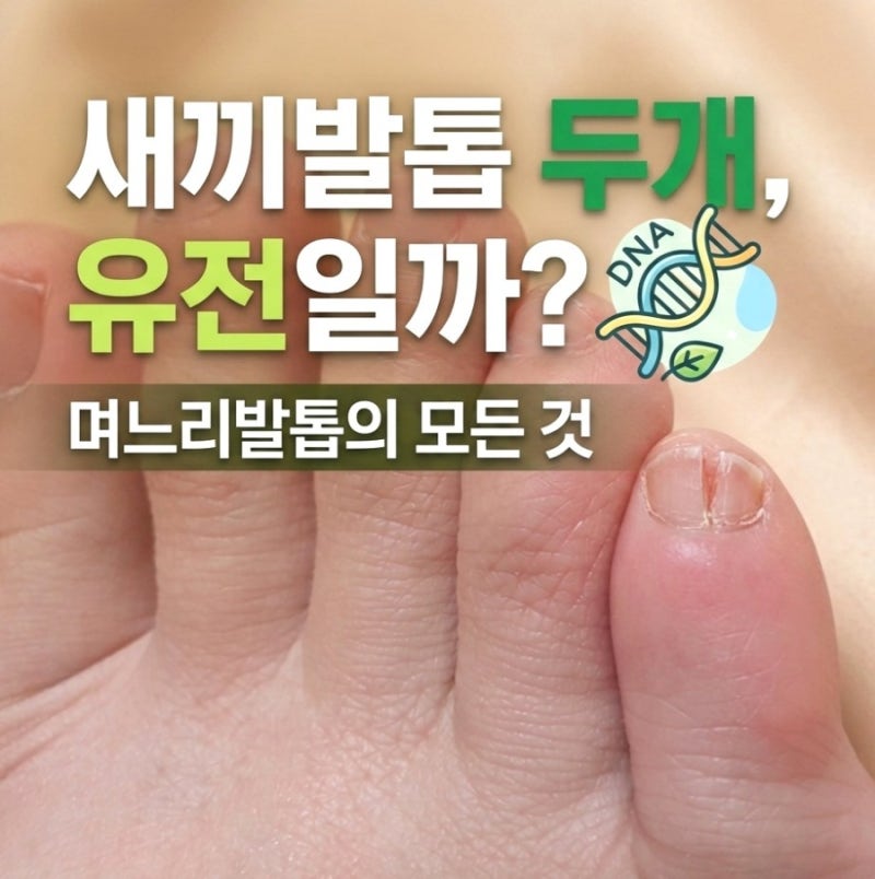 새끼발톱 갈라짐 원인 유전일까? 새끼발톱 두개 며느리발톱 치료 관리 방법