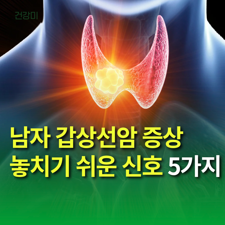 남자 갑상선암 증상 놓치기 쉬운 신호 5가지, 단순 혹일까?