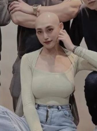 20대 인플루언서 사망…“근육통인 줄 알았는데 암이었다” 림프종 쉽게 정리