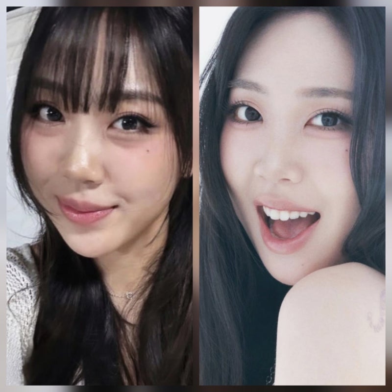 Lee Young-ji's Transformed Beauty After Under-Eye Fat Repositioning... "The Reason I Decided After 4 Years of Deliberation"