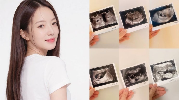 “늙은 엄빠” 발언 <b>김민경</b> 누구지… 미스코리아→<b>배우</b> 이력 정리
