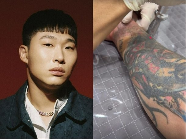 스윙스, 빅나티와 갈등 후 타투 제거 .. "고통스럽지만 지운다"