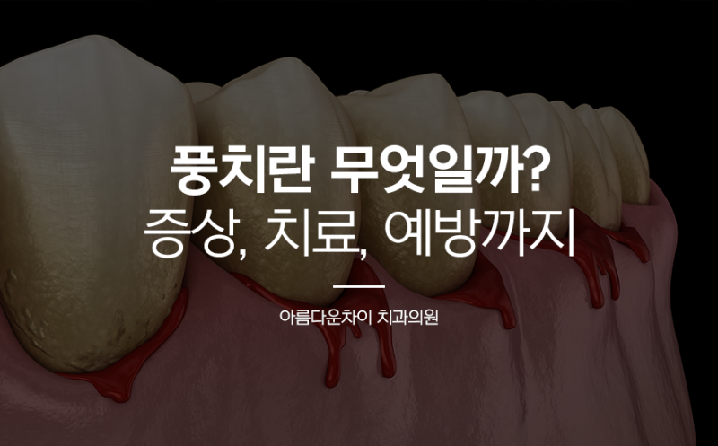 풍치 뜻부터 증상, 치료, 예방까지 알아봐요!