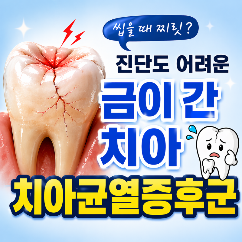 씹을 때 아픈데 충치 아니라고요? 치아균열증후군 의심해보세요
