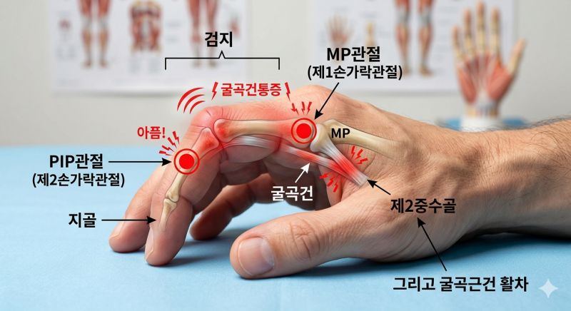 마우스 많이 썼더니 검지 마디가 아픈 이유_검지통증