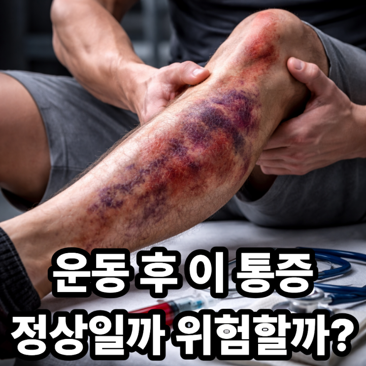  운동 후 급성구획증후군 발생 가능성 얼마나 될까｜확률과 위험 신호 총정리
