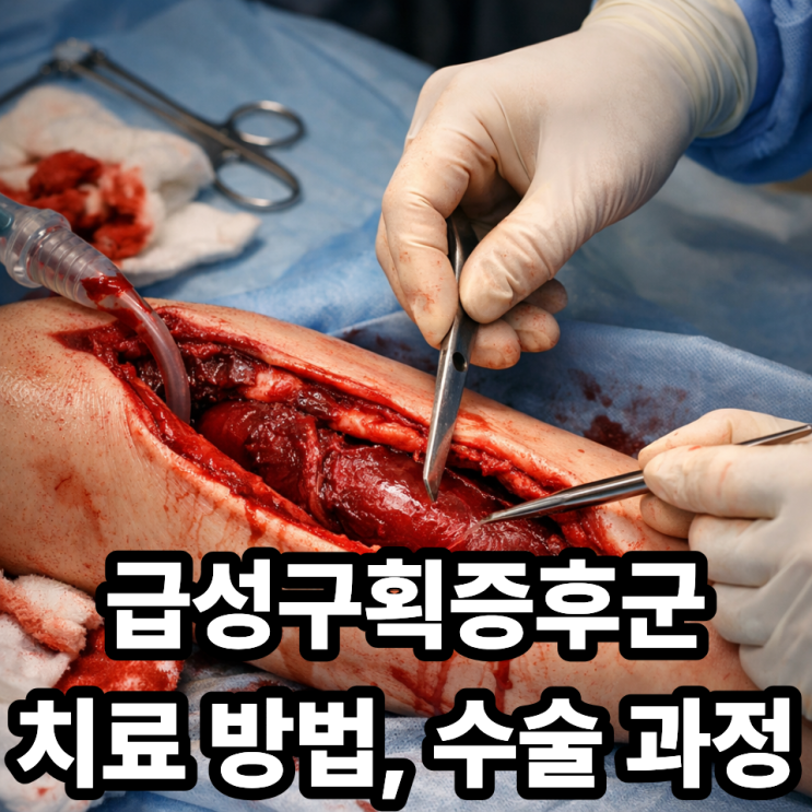  급성구획증후군 치료 방법과 수술 과정｜응급수술 꼭 필요한 이유
