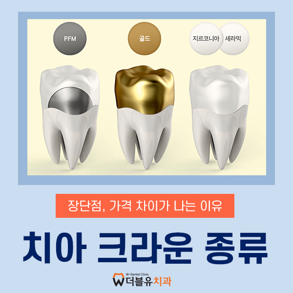치아 크라운 종류 장단점, 가격 차이가 나는 이유