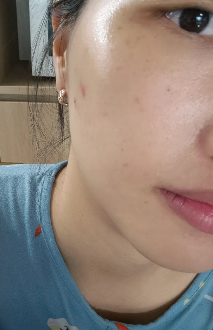  에이버화장품 엑소좀 크림 후기