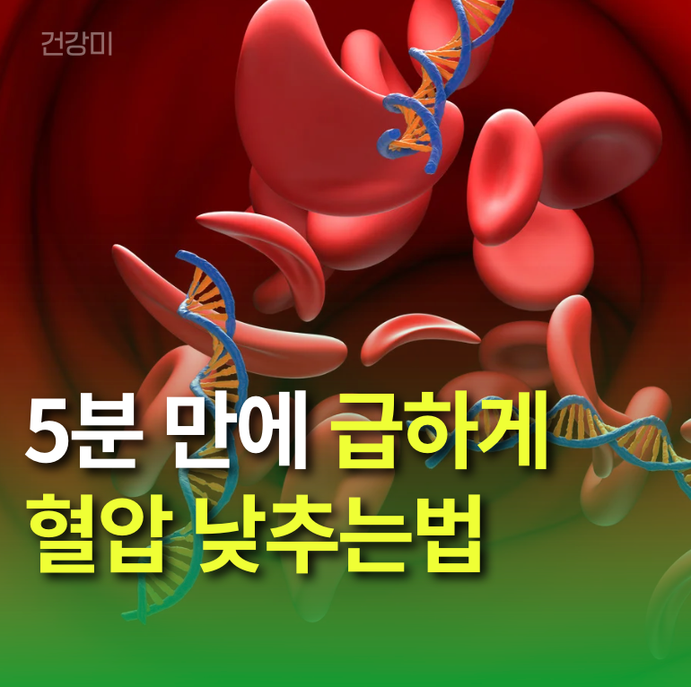 5분 만에 급하게 혈압 낮추는법 혈압 뚝 떨어뜨리는 응급 처치!