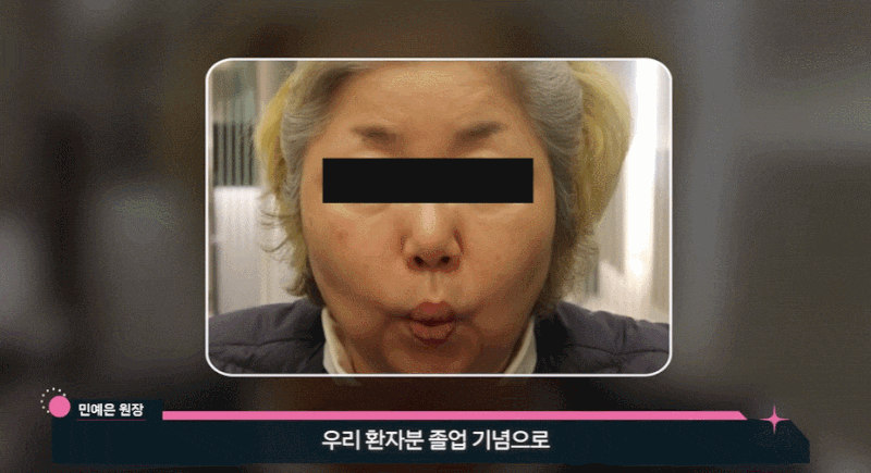 구안와사 재발? 초기 치료와 신경 면역력이 답입니다