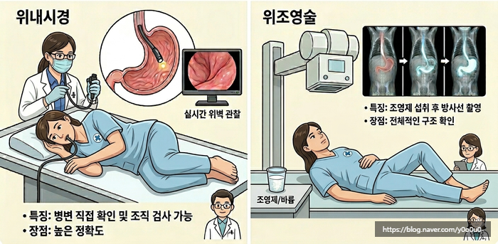 위내시경 vs 위장관조영술 차이 (feat. 건강검진 선택검사)
