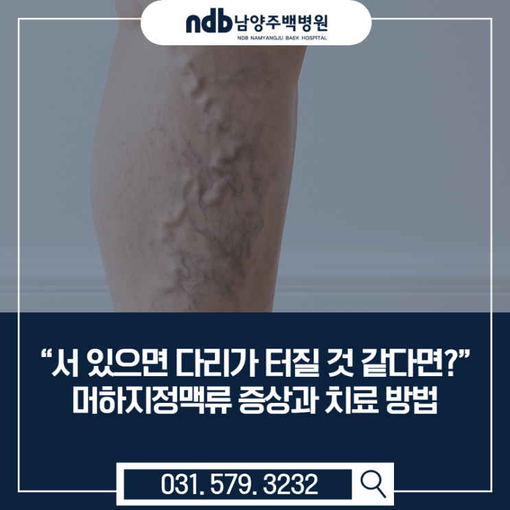  남양주 하지정맥류 수술병원｜서 있을 때 다리가 터질 듯 아프다면?