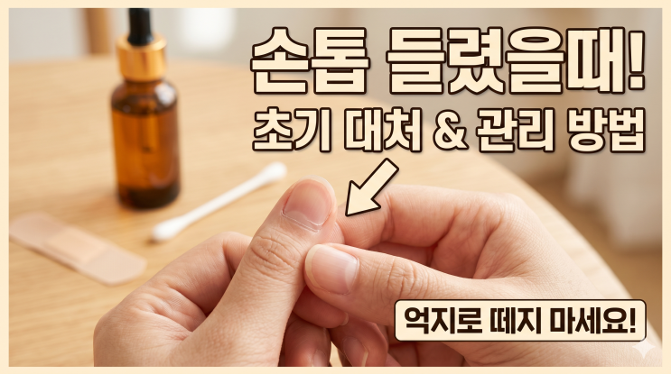  손톱 들렸을때 대처방법, 통증 줄이는 관리법 정리