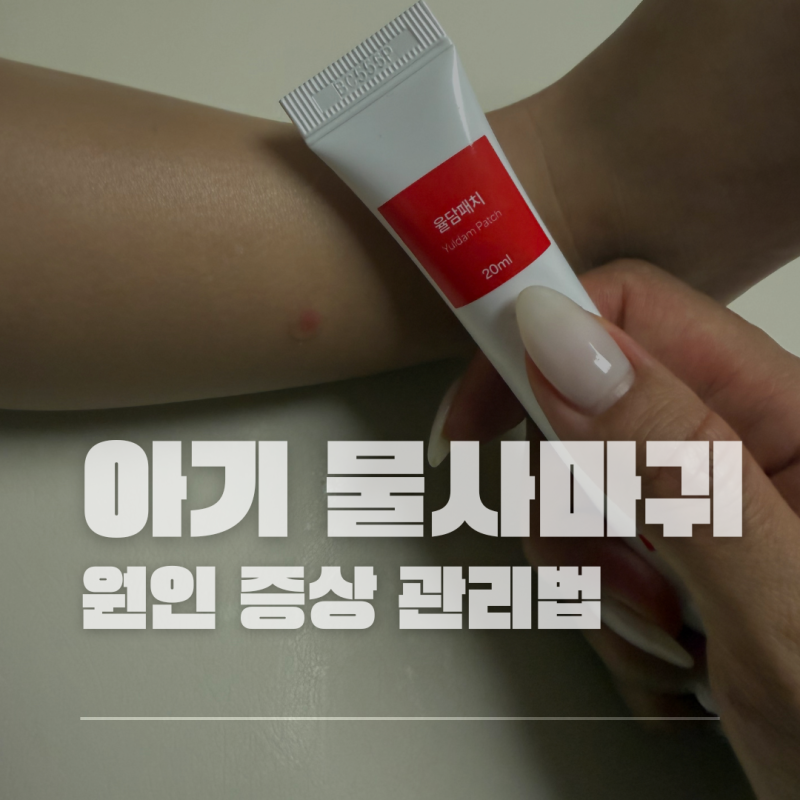영유아 물사마귀 원인과 증상 아기 율담패치로 관리해본 후기