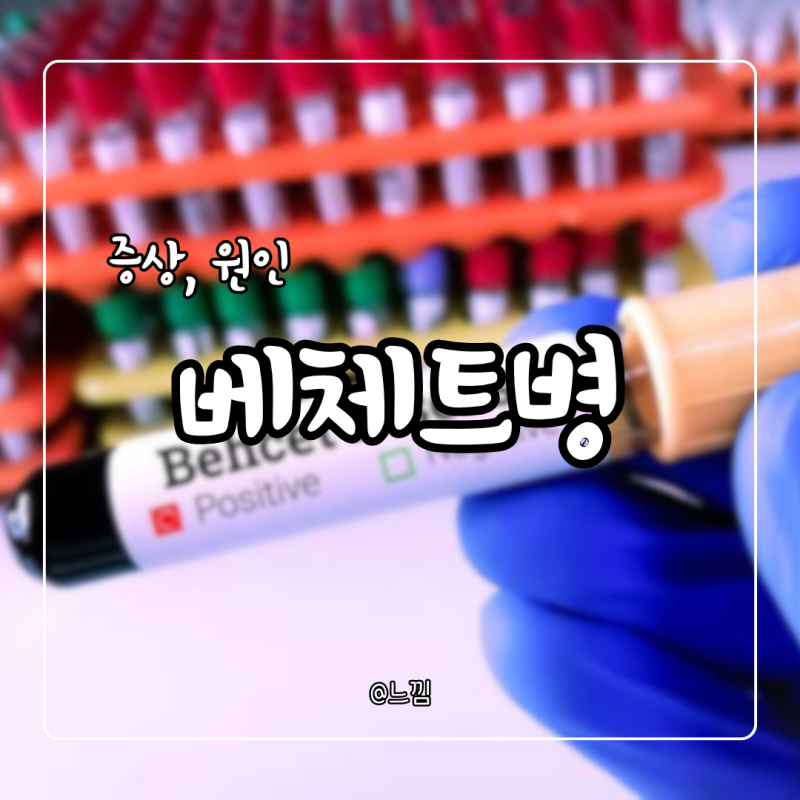 베체트병 증상 원인 치료 검사 완치