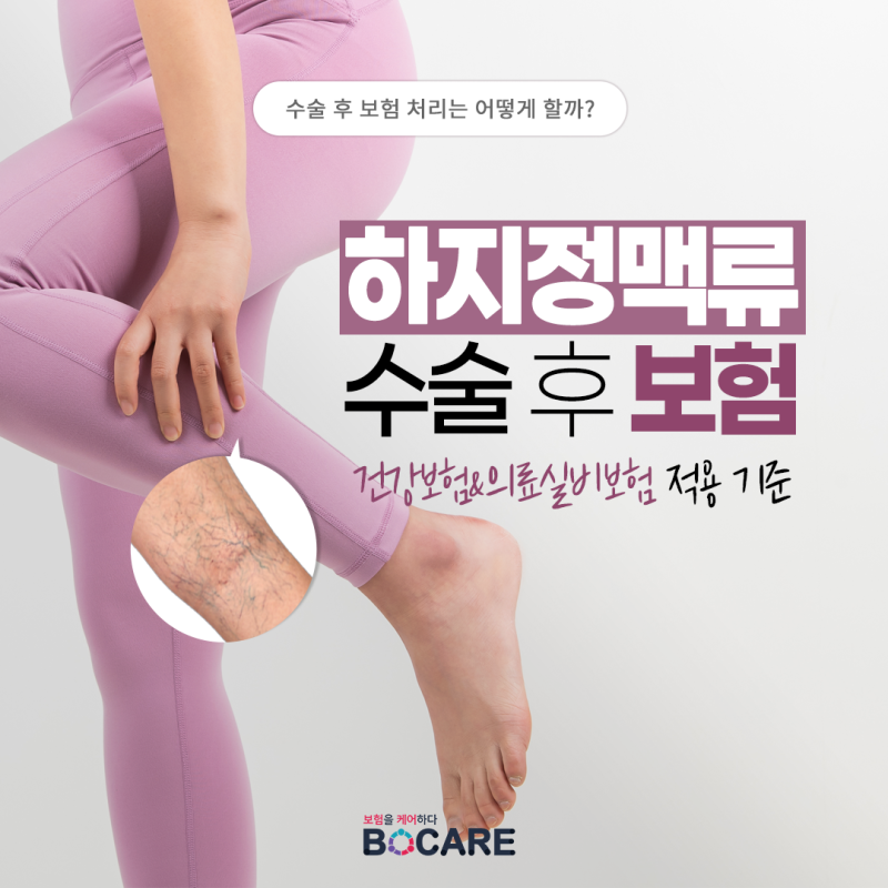 하지정맥류 수술, 실비 보험 받을 수 있을까? (적용 기준 및 주의사항 총정리)