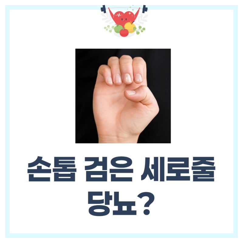 손톱 검은세로줄 당뇨 전조증상? 원인 5가지와 병원 가야하는 상황 총정리
