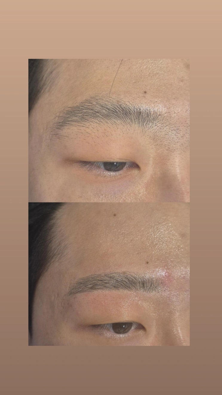  남자 눈썹 왁싱으로 선명하고 또렷한 인상으로 변신하세요, 영등포 왁싱샵 "청춘케어"