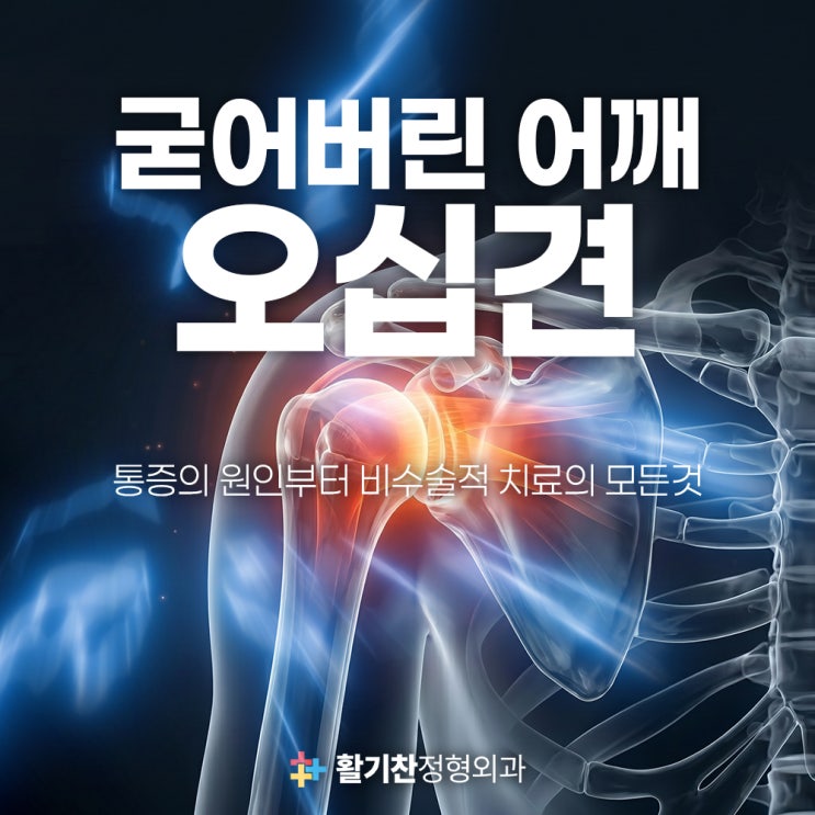  진관동오십견, 어깨가 안 올라가는 이유는