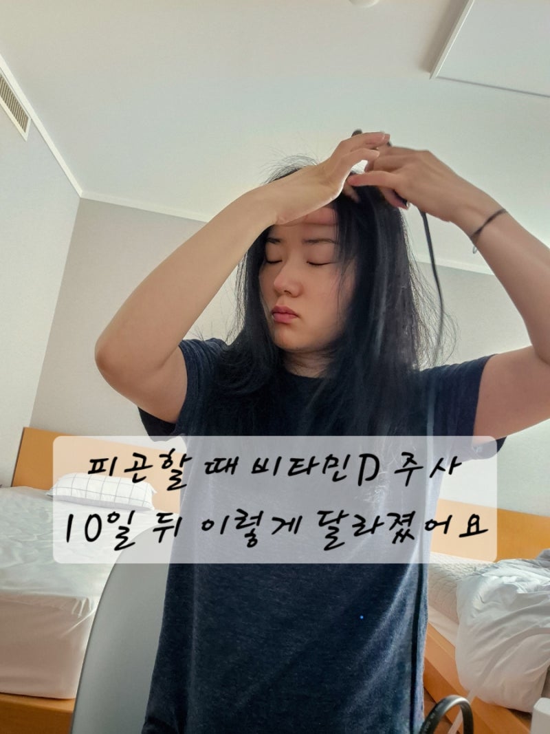 비타민D 주사 효과 있을까요? 피곤할 때 영양제 대신 맞아본 후기 (10일 변화 + 유지기간)