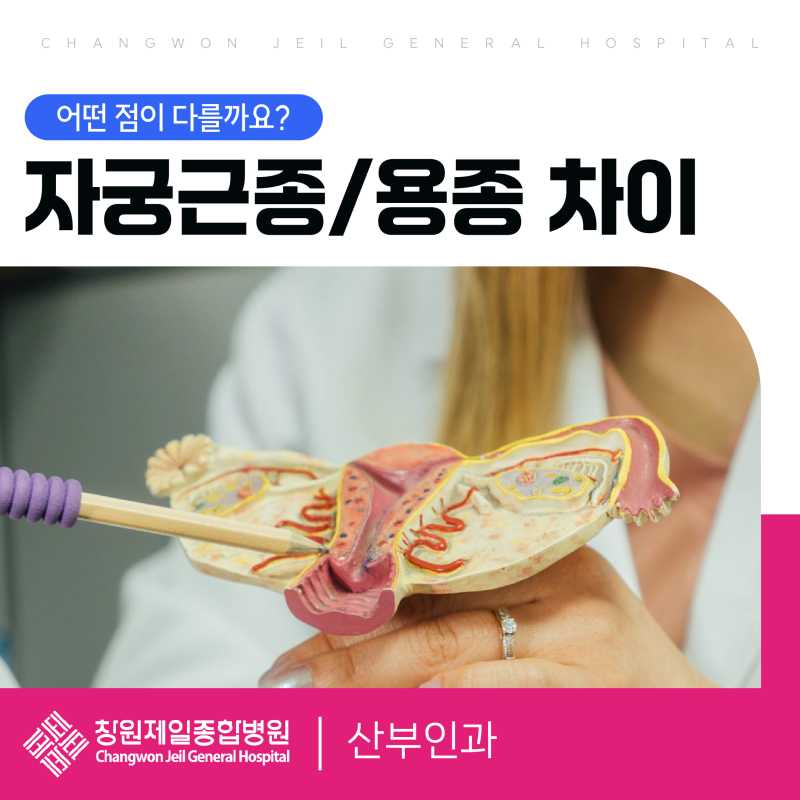 자궁근종과 용종의 차이점