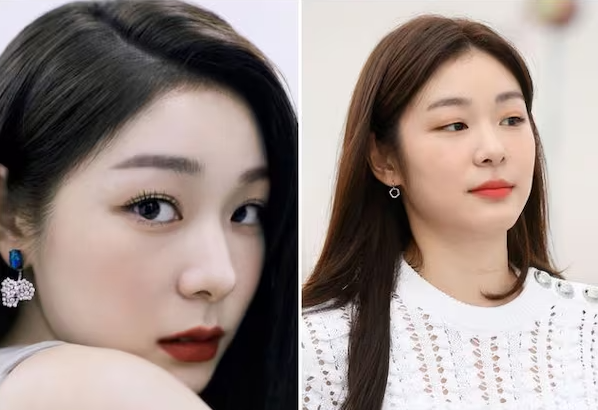 김연아 쌍꺼풀 수술 의혹 10년 변천사 모아보기