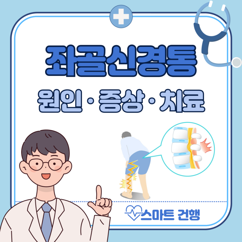 좌골신경통 증상, 원인, 치료 방법 : 운동, 스트레칭