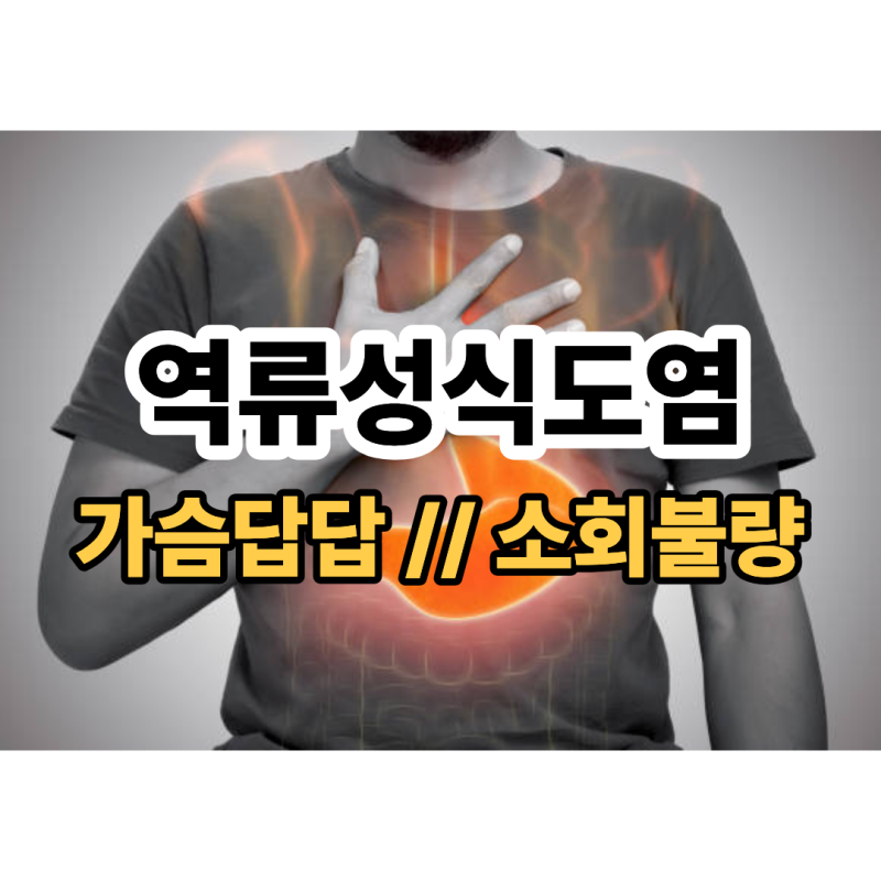 역류성식도염 증상 가슴답답하고 소화불량 있을 때 ‘이 음식’ 챙기시면 좋아요