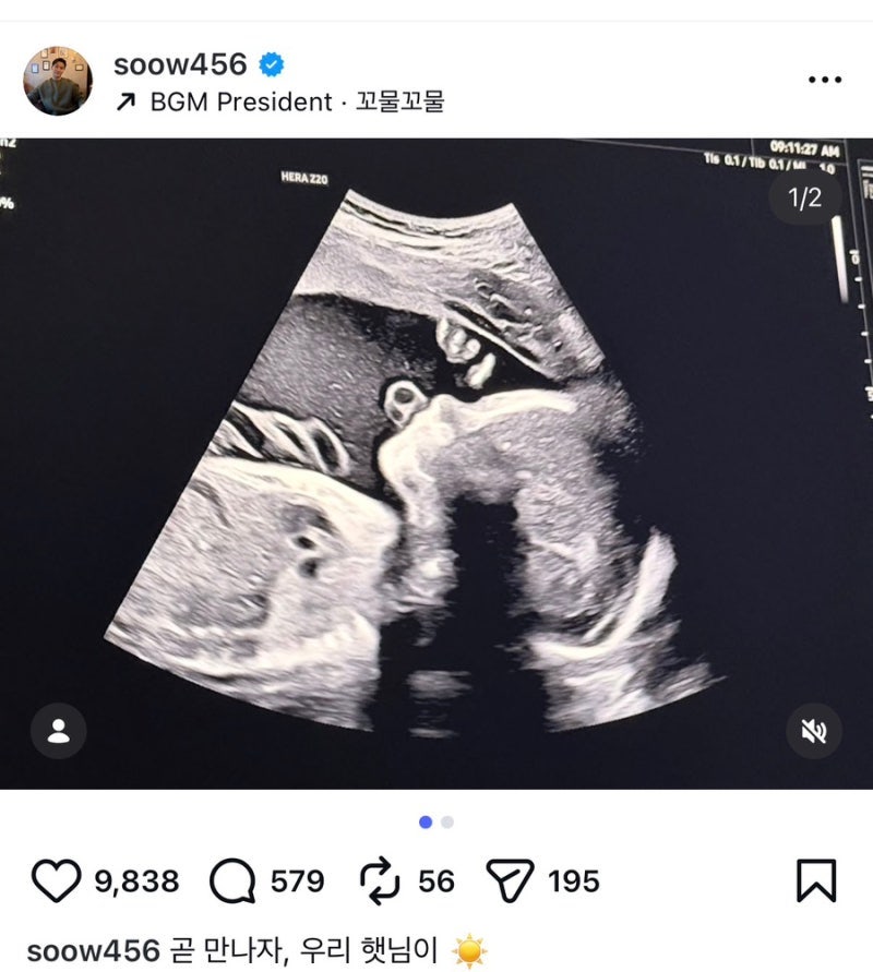 FT아일랜드 송승현 아빠 된다, 2세 초음파 공개 와이프 누구 프로필 근황 총정리