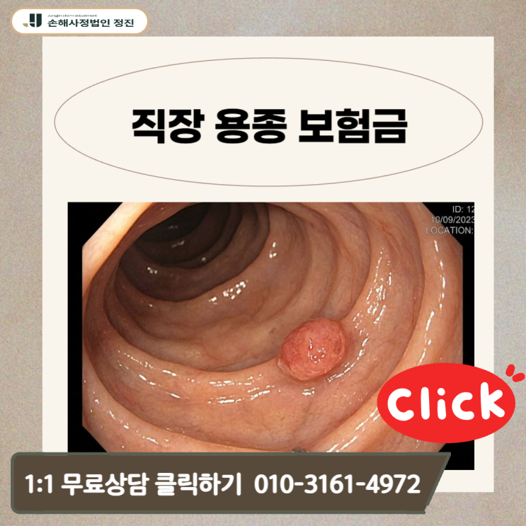  직장 용종 보험금, D12.8인데 10 0% 받는 기준 (제자리암 인정 핵심)
